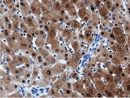 AK5 / Adenylate Kinase 5 Antibody (clone OTI2A2)