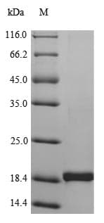 Human TNF Alpha Protein (Recombinant 6His, N-terminus)