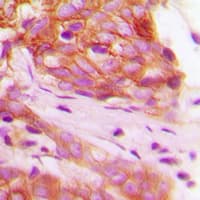 Polyclonal Rabbit anti-Human FGFR1 / FGF Receptor 1 Antibody (phospho-Tyr766, IHC, WB)