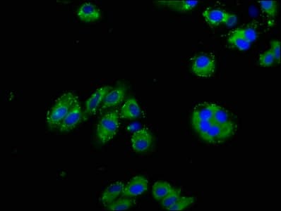 NPHS1 / Nephrin Antibody (aa23-257)