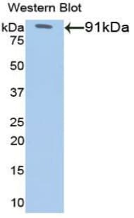 G6PD Antibody (aa1-515)