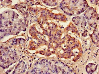 IHC-plus™ Polyclonal Rabbit anti-Human FAM134B Antibody (IHC)