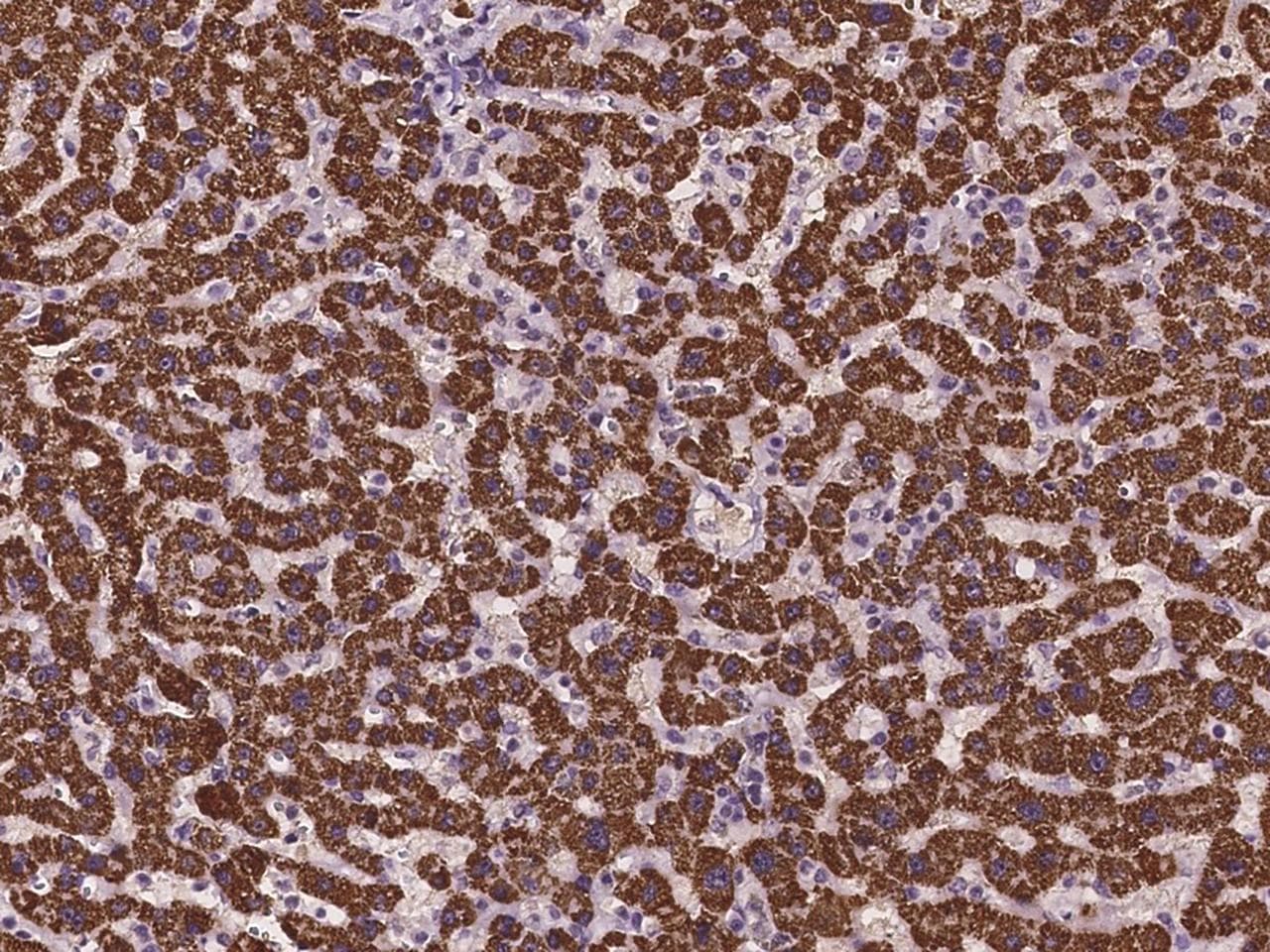 ABAT Antibody