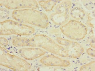 SLC22A8 / OAT3 Antibody