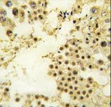Polyclonal Rabbit anti-Human ZFP219 / ZNF219 Antibody (aa154-183, IHC, WB)