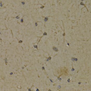 ALOX5 / 5-LOX Antibody