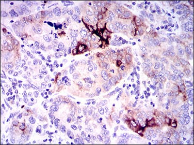 Monoclonal Mouse anti-Human SPP1 / Osteopontin Antibody (clone 7C5H12, IHC, IF, WB)