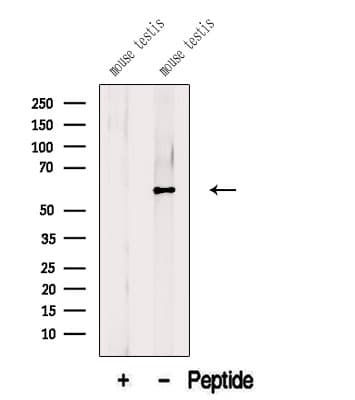 BBS9 Antibody