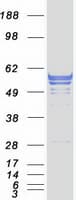 Human CNDP1 Protein (Recombinant Myc-DDK (Flag))