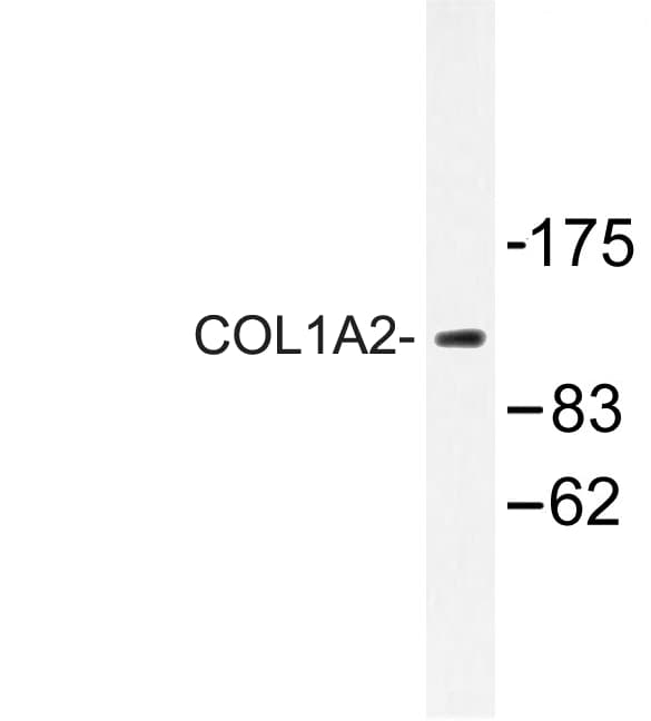 COL1A2 / Collagen I Alpha 2 Antibody (Thr501)