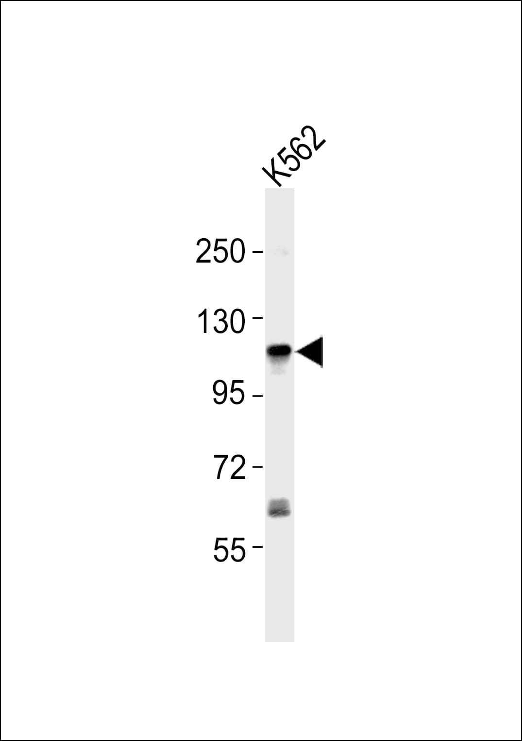 Polyclonal Rabbit anti-Human ARTS1 / ERAP1 Antibody (WB)