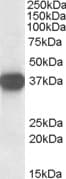 IHC-plus™ Polyclonal Goat anti-Human NPM1 / NPM / Nucleophosmin Antibody (aa281-294, IHC, WB)