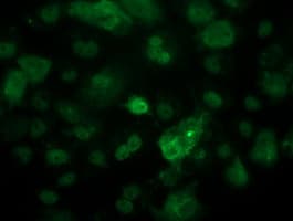 Monoclonal Mouse anti-Human TP53 / p53 Antibody (clone OTI3F5, IHC, IF, WB)