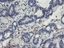 PECAM-1 / CD31 Antibody (clone OTI3G4)