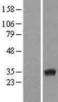 SDR9C7 Protein (Over-Expression Lysate Myc-DDK (Flag))