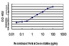 IHC-plus™ HIPK2 Antibody (clone 1F10)
