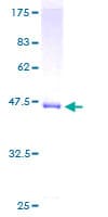 Human NUDT1 / MTH1 Protein (Recombinant GST)