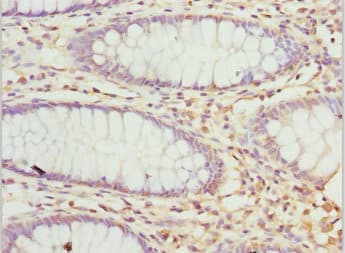 Peripherin Antibody (aa1-260)