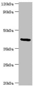 GOLM1 / GP73 / GOLPH2 Antibody (aa112-401)