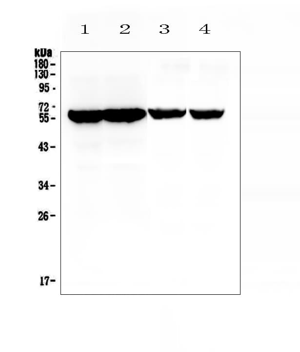 CYP17 / CYP17A1 Antibody