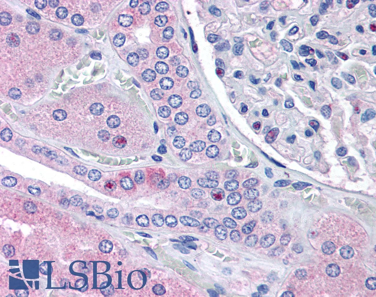 IHC-plus™ RNF213 Antibody (aa5244-5254)