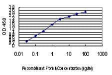 Monoclonal Mouse anti-Human TRIM33 / TIF1-Gamma Antibody (clone 6D1, IHC, IF, WB)