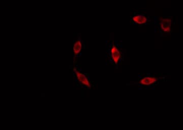 PRKCQ / PKC-Theta Antibody (phospho-Ser676)