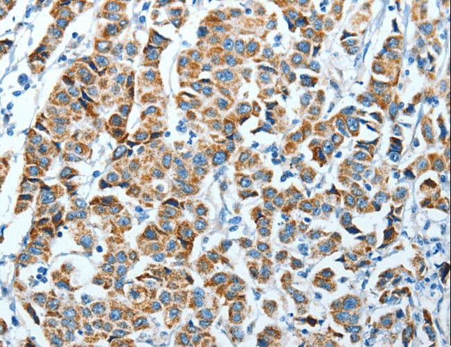 Polyclonal Rabbit anti-Human P5CDH / ALDH4A1 Antibody (IHC, WB)