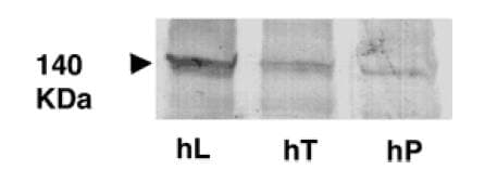 IHC-plus™ Monoclonal Mouse anti-Human ABCB11 / BSEP Antibody (aa705-718, IHC, WB)