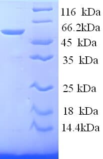 Human SAG / Arrestin Protein (Recombinant His)