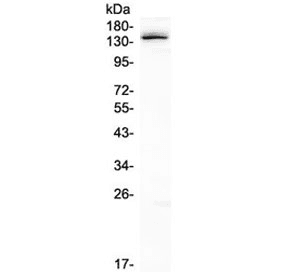 Polyclonal Rabbit anti-Human LATS1 Antibody (IHC, WB)