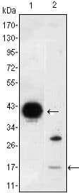 Monoclonal Mouse anti-Human I-FABP / FABP2 Antibody (clone 9A9B7B3, IHC, IF, WB)