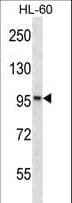 KANK2 Antibody (aa465-493)