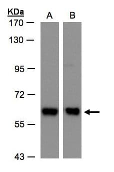 COPD / ARCN1 Antibody (aa89-511)
