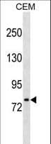 Polyclonal Rabbit anti-Human LONRF3 Antibody (aa677-704, WB)