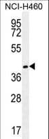 GGH / Gamma-Glutamyl Hydrolase Antibody (aa229-256)