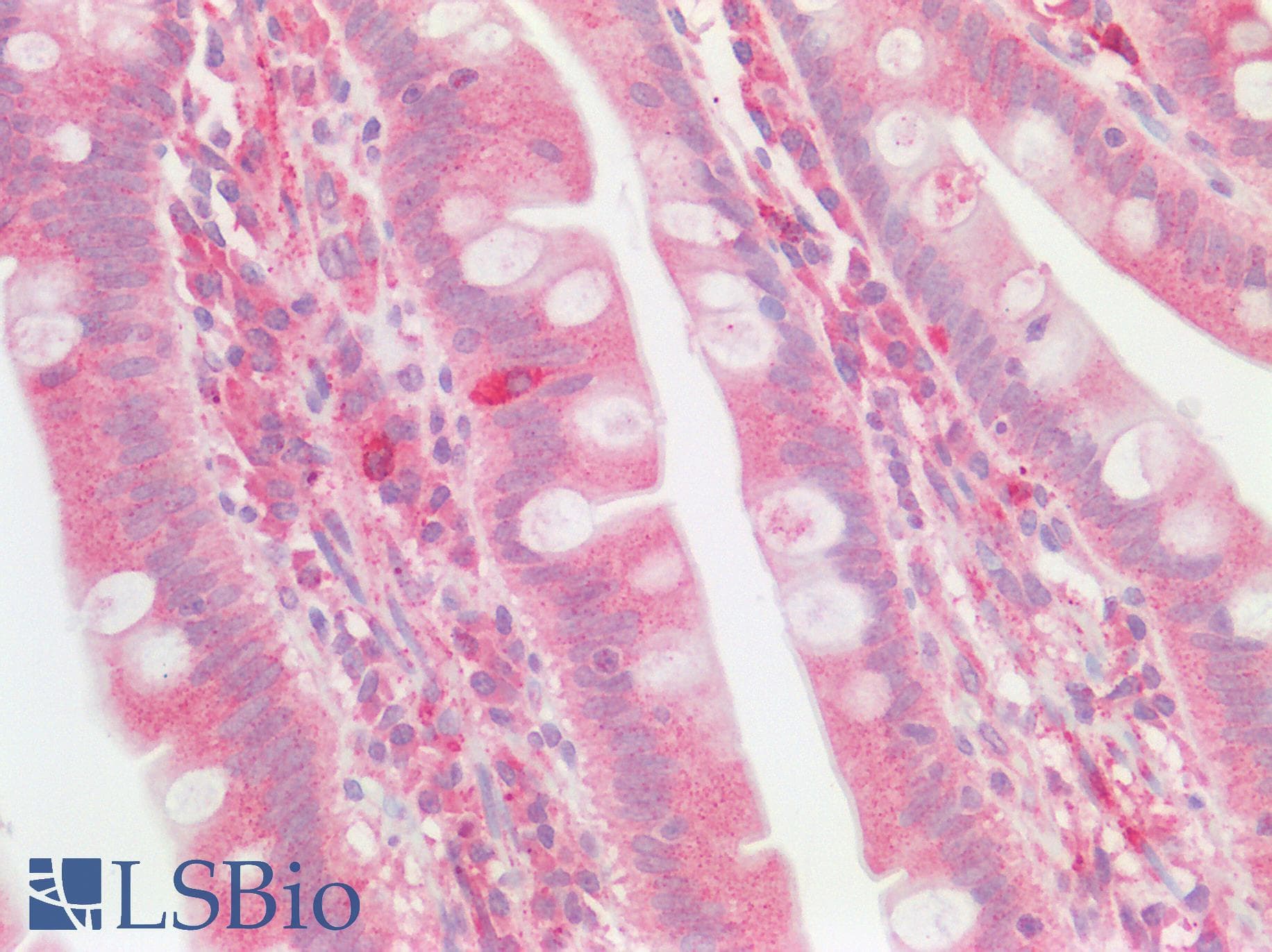 RALA / RAL Antibody (aa71-120)