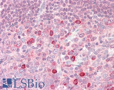 IHC-plus™ Polyclonal Rabbit anti-Human BATF Antibody (aa7-35, IHC, WB)