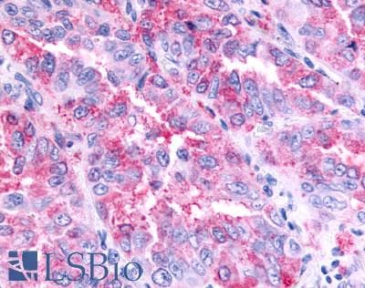 PathPlus™ Polyclonal Rabbit anti-Human GPR45 Antibody (Cytoplasmic Domain, IHC)