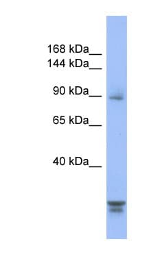 Polyclonal Rabbit anti-Human PPP2R3A / PR130 Antibody (aa179-228, IHC, WB)