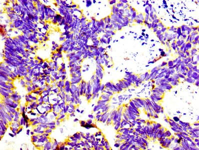 CD74 / CLIP Antibody