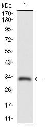 ABCC4 / MRP4 Antibody (aa631-692, clone 6A7H3)