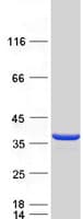 Human CLYBL Protein (Recombinant Myc-DDK (Flag))