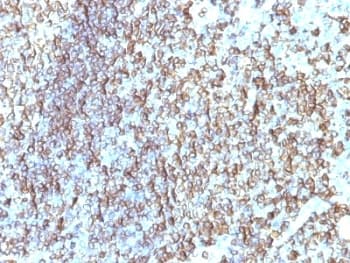 HLA-DRB1 Antibody (clone SPM288)