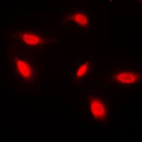 ANAPC1 / APC1 Antibody (Internal)