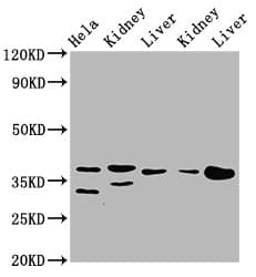 Polyclonal Rabbit anti-Human PPA2 Antibody (IHC, WB)