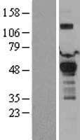 Human PDK1 Protein (Over-Expression Lysate Myc-DDK (Flag))