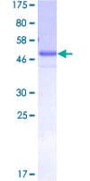 Human SALL2 Protein (Recombinant GST)