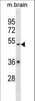 CAMKV Antibody (aa46-73)