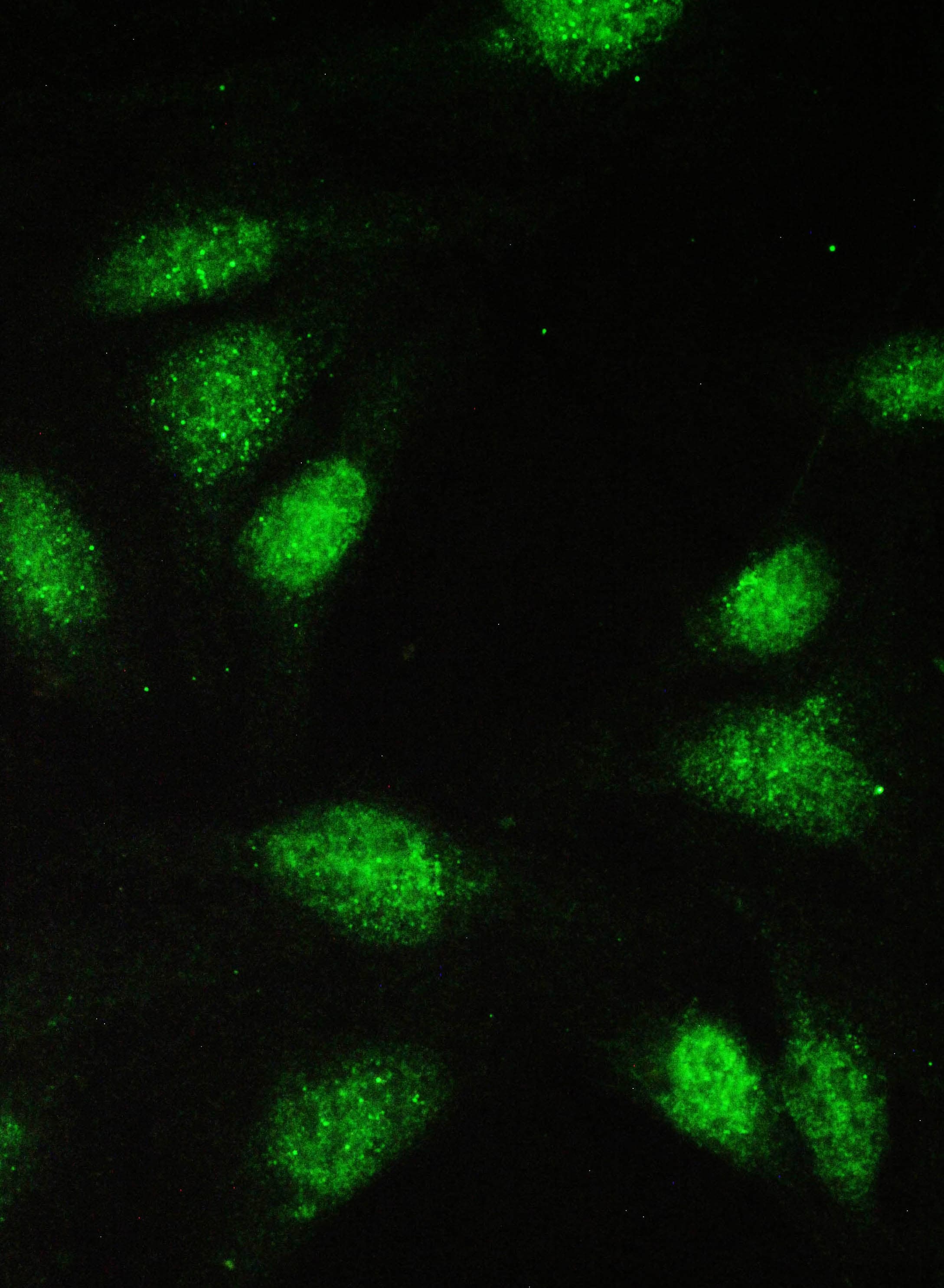 Polyclonal Rabbit anti-Human PAX5 Antibody (IHC, WB)